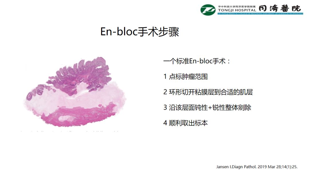 Ƶ-En-bloc