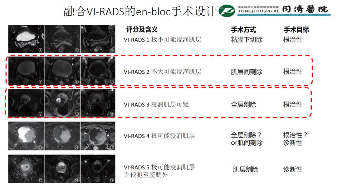 Ƶ,ںVI-RADSen-bloc